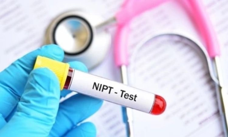 NIPT vs Double Marker Test