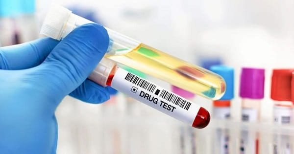 Is Drug Testing Business Profitable in India?
