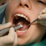 Dental Treatment